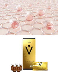 V-TECH Exosoma